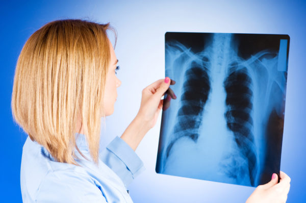 Врач изучает рентгеновские снимки лёгких