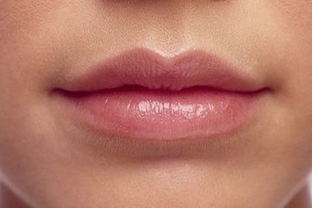 5 способов спасти губы, если бальзамы уже не помогают