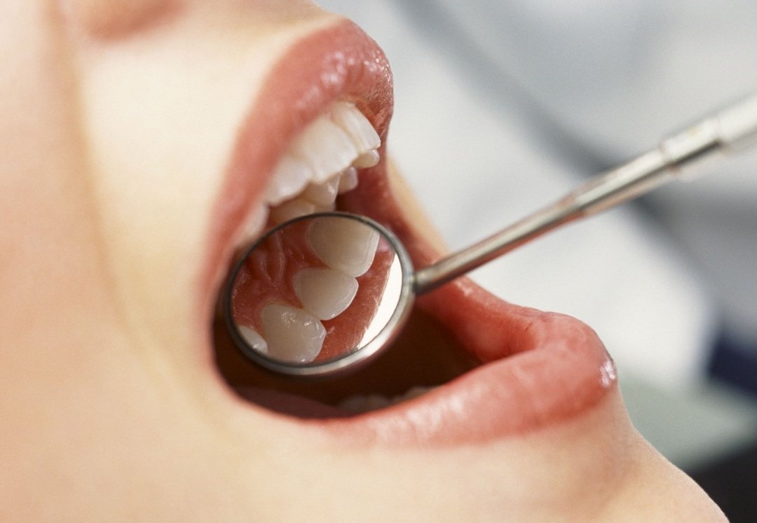 Проверка зубок у стоматолога
